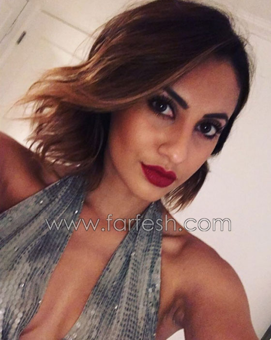 بسبب الذئبة.. سيلينا غوميز تخضع لعملية زرع كلية والمتبرعة صديقتها  صورة رقم 17