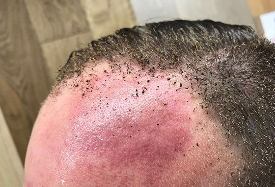 رفع حالة التأهب في بريطانيا وداعش يعلن مسؤوليته عن تفجير مترو الانفاق صورة رقم 24