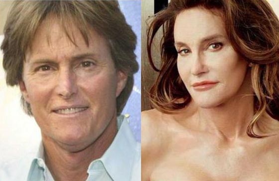 صور نجمات قبل وبعد عمليات التجميل: احداهن دفعت 2 مليون دولار صورة رقم 6