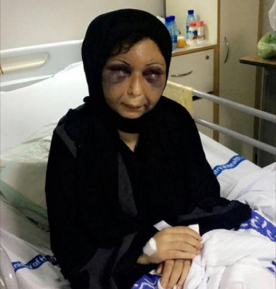 فيديو عنيف: زوج بحالة هستيرية يضرب راس زوجته بالحائط ناويا قتلها.. وهذه هي النتيجة! صورة رقم 1