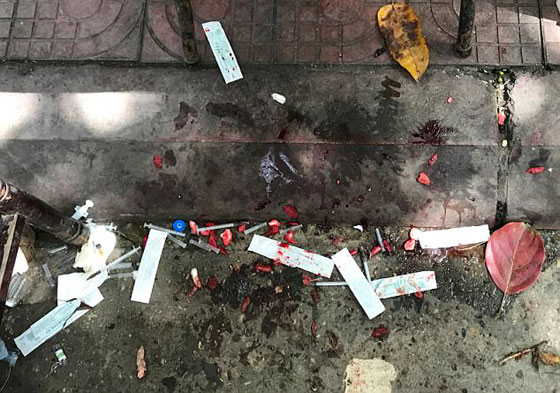 فيديو صادم.. عمليات وحشية تتم لمنع الكلاب من النباح! صورة رقم 4