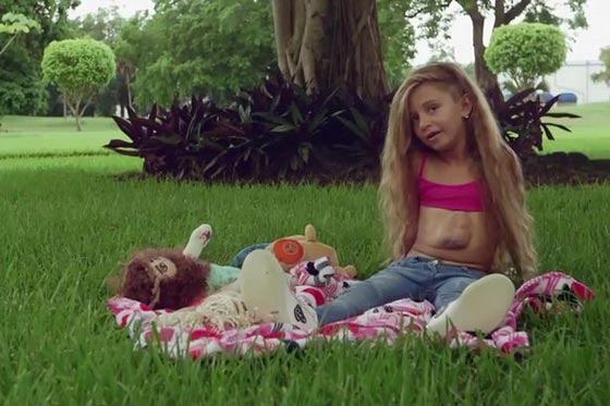 فيديو مذهل.. قلب طفلة ينبض خارج صدرها صورة رقم 4