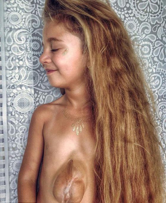 فيديو مذهل.. قلب طفلة ينبض خارج صدرها صورة رقم 12