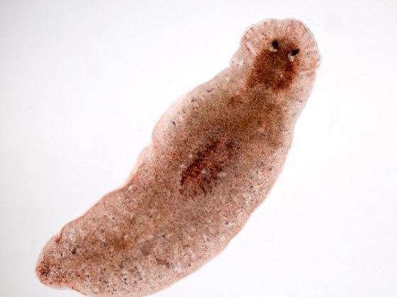 فيديو مخيف.. دودة تزحف في عين فتى وتتسبب في فقدانه الرؤية! صورة رقم 1