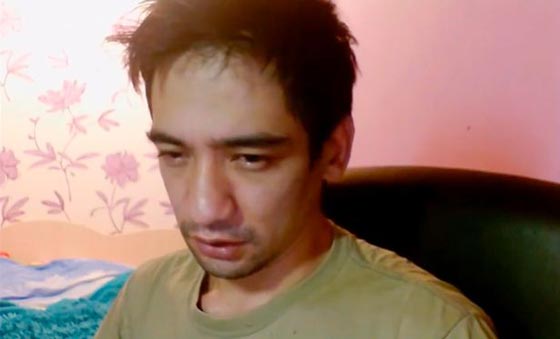 خبير حيوانات روسي يموت بالبث المباشر من لدغة افعى صورة رقم 2