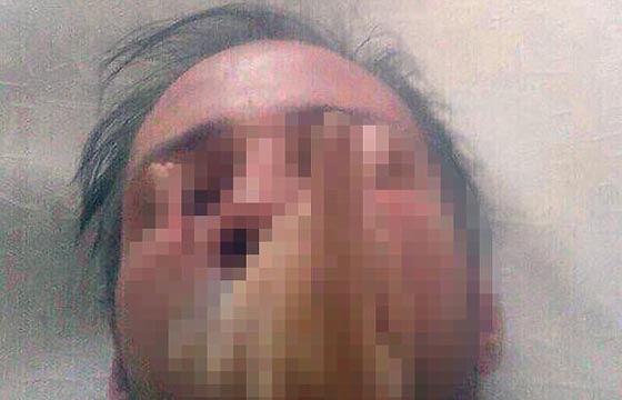 زوجان روسيان يأكلان لحوم البشر وصور لاشلاء امرأة تفضحهما! صورة رقم 3