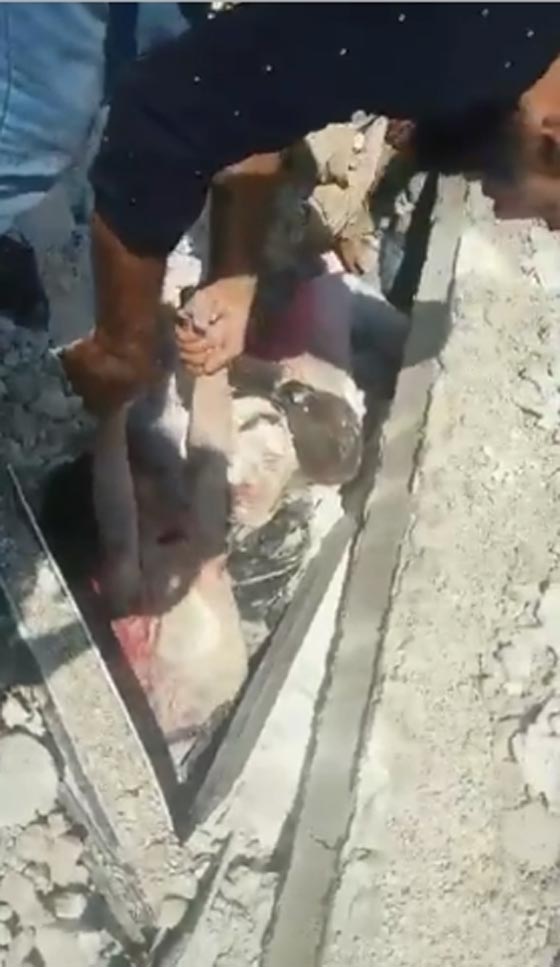 طفلة سورية تحطم القلوب وتصرخ من تحت الردم: أبوس رجليك يا بابا صورة رقم 1