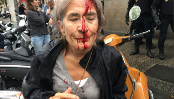 يوم دام في كتالونيا.. أين حقوق الإنسان مما حدث؟! صورة رقم 1