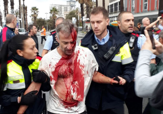 يوم دام في كتالونيا.. أين حقوق الإنسان مما حدث؟! صورة رقم 13
