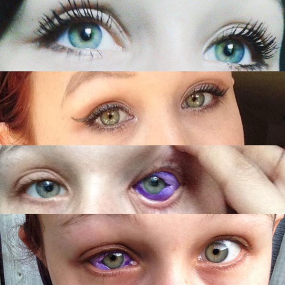 آخر صيحات الموضة.. عارضة أزياء كندية تتعرَّض لعمىً جزئيٍّ والسبب؟ صورة رقم 1