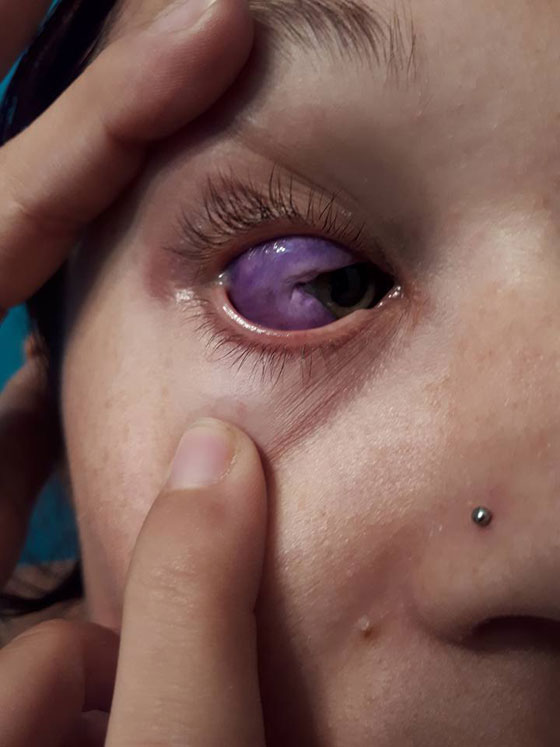 آخر صيحات الموضة.. عارضة أزياء كندية تتعرَّض لعمىً جزئيٍّ والسبب؟ صورة رقم 11