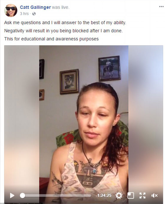 آخر صيحات الموضة.. عارضة أزياء كندية تتعرَّض لعمىً جزئيٍّ والسبب؟ صورة رقم 6