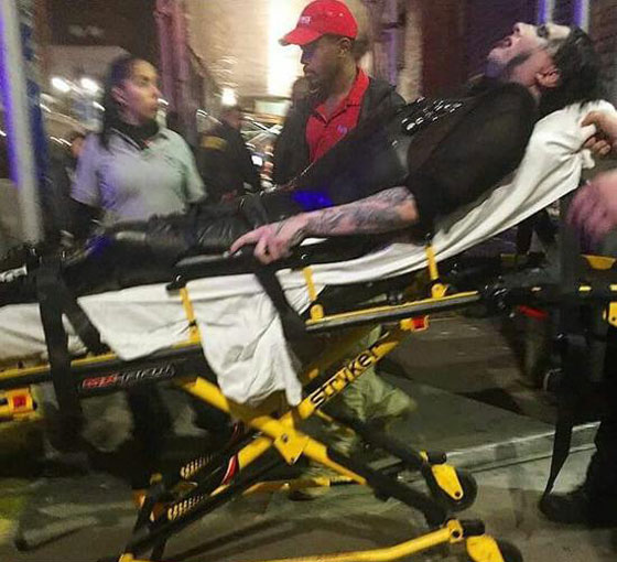 فيديو لحظة سقوط ديكور المسرح على نجم الروك مارلين مانسن في نيويورك صورة رقم 9