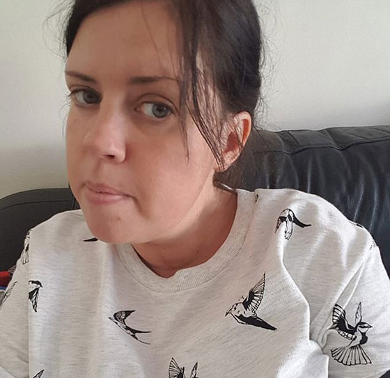 بالصور.. سيدة بريطانية مدمنة على أكل الإسفنج صورة رقم 6