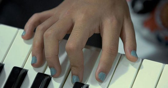 عائلةٌ برازيلية أفرادها بـ6 أصابع حولتهم معاناتهم إلى مشهورين صورة رقم 6 عائلةٌ برازيلية أفرادها بـ6 أصابع حولتهم معاناتهم إلى مشهورين صورة رقم 6