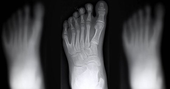 عائلةٌ برازيلية أفرادها بـ6 أصابع حولتهم معاناتهم إلى مشهورين صورة رقم 8 عائلةٌ برازيلية أفرادها بـ6 أصابع حولتهم معاناتهم إلى مشهورين صورة رقم 8