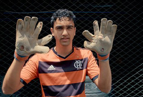 عائلةٌ برازيلية أفرادها بـ6 أصابع حولتهم معاناتهم إلى مشهورين صورة رقم 10 عائلةٌ برازيلية أفرادها بـ6 أصابع حولتهم معاناتهم إلى مشهورين صورة رقم 10