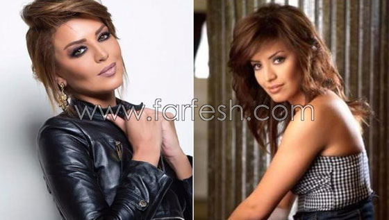 صور نجمات الفن قبل وبعد عمليات التجميل.. البعض تشوه وجههن! صورة رقم 6