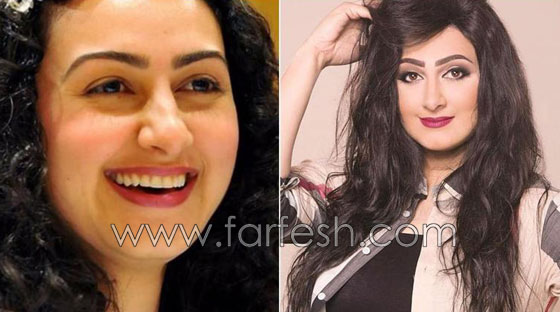 صور نجمات الفن قبل وبعد عمليات التجميل.. البعض تشوه وجههن! صورة رقم 8
