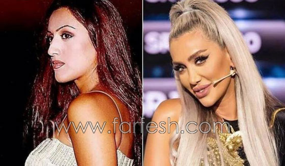 صور نجمات الفن قبل وبعد عمليات التجميل.. البعض تشوه وجههن! صورة رقم 10