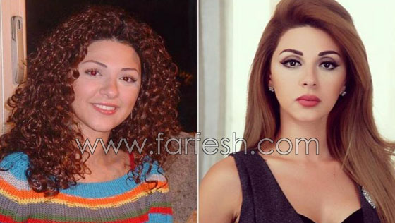 صور نجمات الفن قبل وبعد عمليات التجميل.. البعض تشوه وجههن! صورة رقم 12