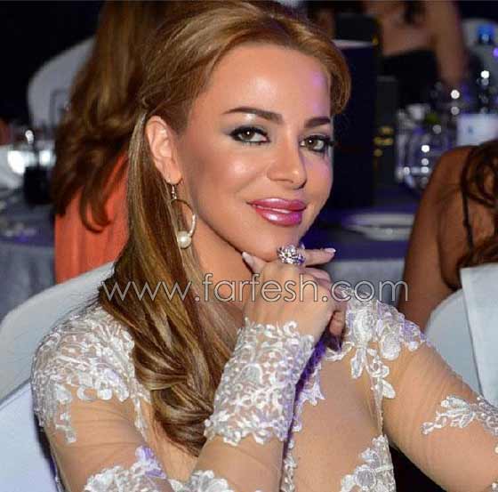 صور صادمة لنجمات عربيات بعد عمليات التجميل بالبوتوكس  صورة رقم 4