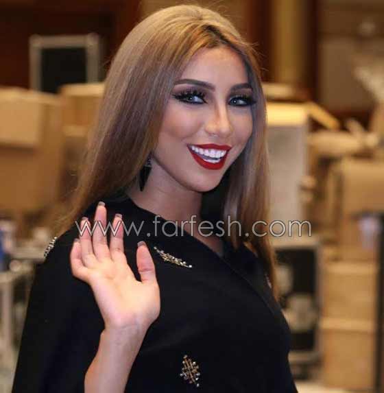 صور صادمة لنجمات عربيات بعد عمليات التجميل بالبوتوكس  صورة رقم 6