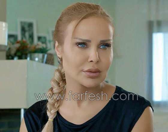 صور صادمة لنجمات عربيات بعد عمليات التجميل بالبوتوكس  صورة رقم 8