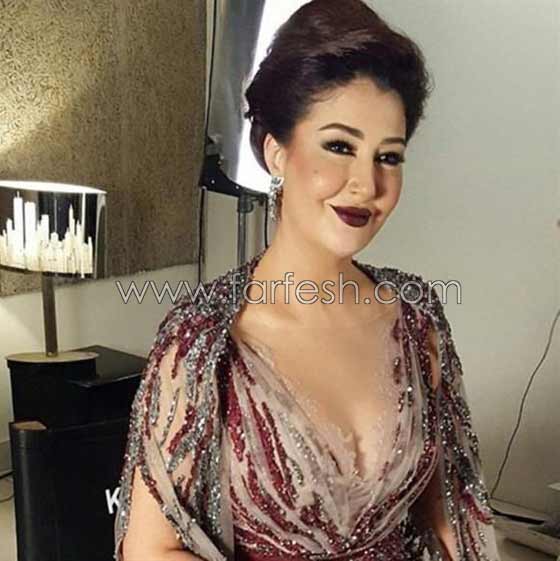 صور صادمة لنجمات عربيات بعد عمليات التجميل بالبوتوكس  صورة رقم 1