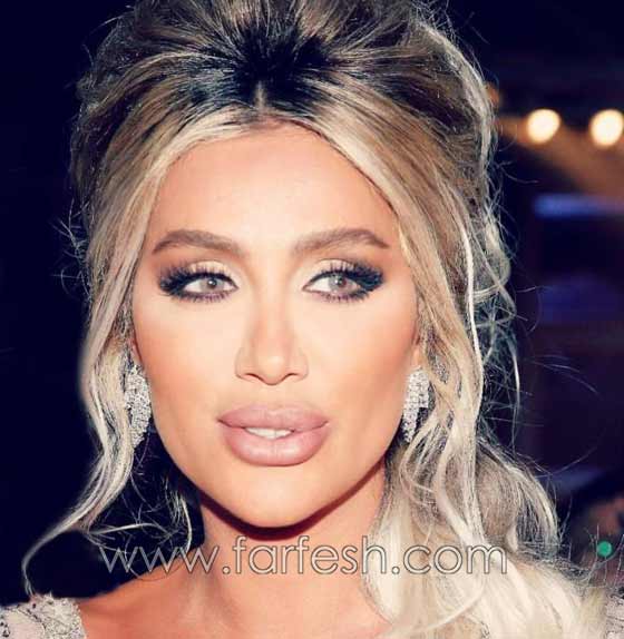 صور صادمة لنجمات عربيات بعد عمليات التجميل بالبوتوكس  صورة رقم 3