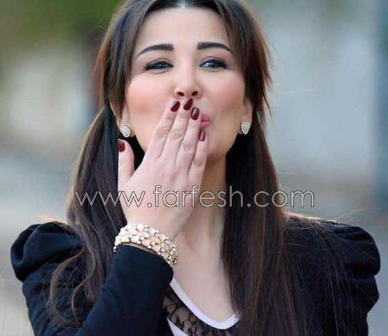 صور صادمة لنجمات عربيات بعد عمليات التجميل بالبوتوكس  صورة رقم 11