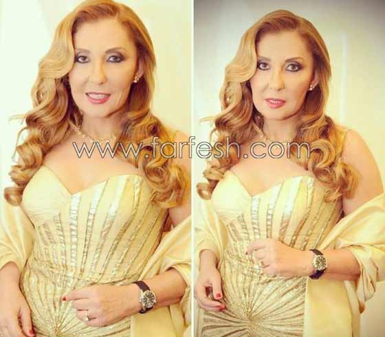صور صادمة لنجمات عربيات بعد عمليات التجميل بالبوتوكس  صورة رقم 13