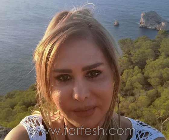 صور صادمة لنجمات عربيات بعد عمليات التجميل بالبوتوكس  صورة رقم 14