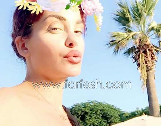 صور صادمة لنجمات عربيات بعد عمليات التجميل بالبوتوكس  صورة رقم 2