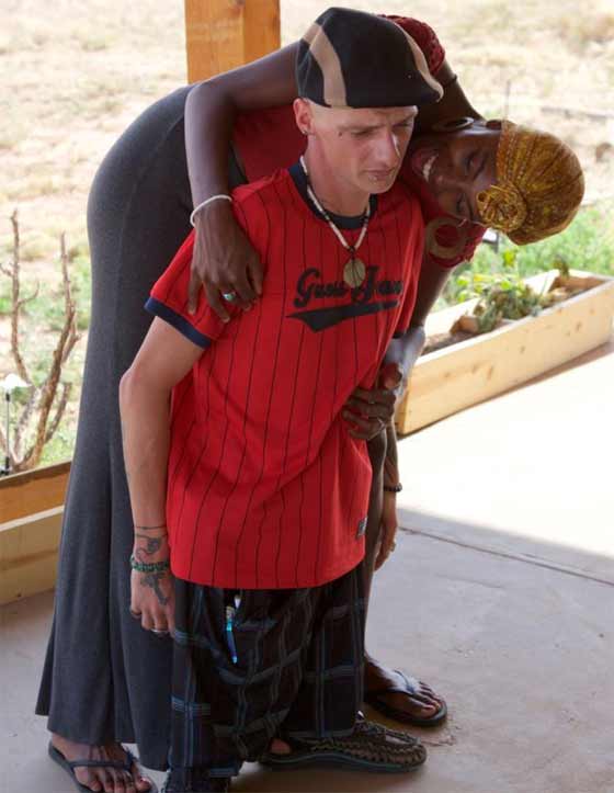 بالصور.. حالة نادرة رجل يمشي دون فخذين صورة رقم 2 بالصور.. حالة نادرة رجل يمشي دون فخذين صورة رقم 2