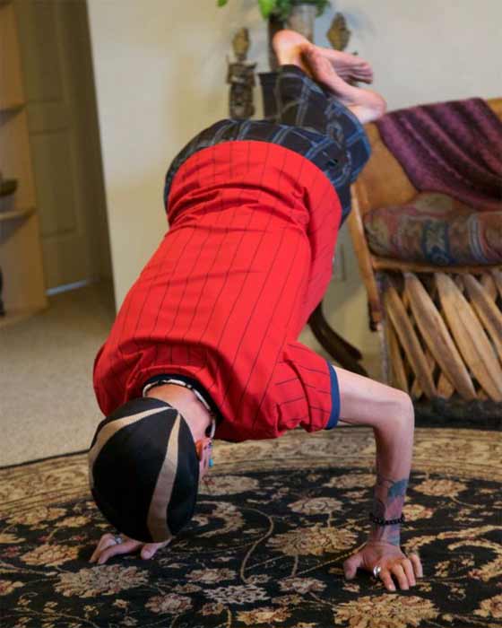 بالصور.. حالة نادرة رجل يمشي دون فخذين صورة رقم 4 بالصور.. حالة نادرة رجل يمشي دون فخذين صورة رقم 4