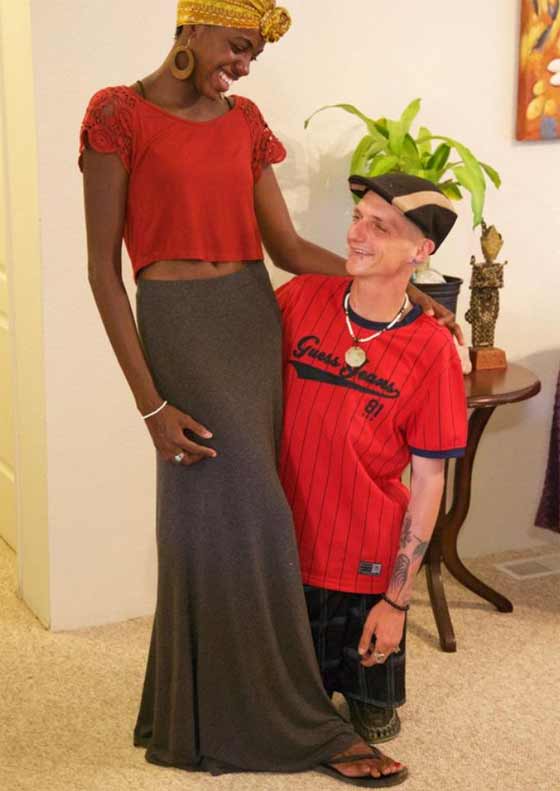 بالصور.. حالة نادرة رجل يمشي دون فخذين صورة رقم 5 بالصور.. حالة نادرة رجل يمشي دون فخذين صورة رقم 5