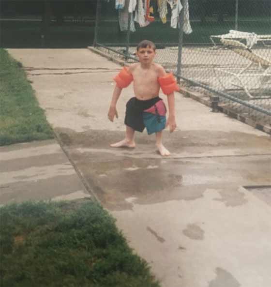 بالصور.. حالة نادرة رجل يمشي دون فخذين صورة رقم 7 بالصور.. حالة نادرة رجل يمشي دون فخذين صورة رقم 7