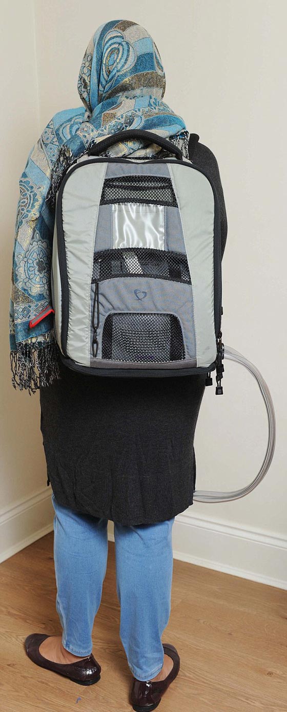 مسلمة بريطانية بدون قلب في جسدها وتحمل قلبها الصناعي في حقيبة! صورة رقم 8