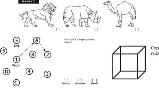اليكم الأسئلة الذهنية التي خضع لها دونالد ترامب صورة رقم 1