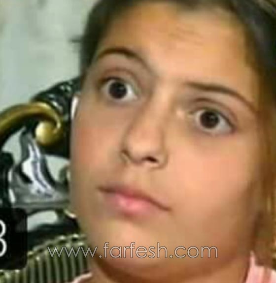 صورة فنانة سورية قبل عمليات التجميل.. لن تصدّقوا من هي! صورة رقم 1