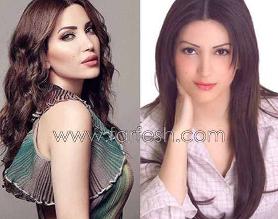 صور فنانات قمن بتكبير الشفاه. بينهن هيفاء واحلام وغادة. الفرق كبير قبل وبعد! صورة رقم 2