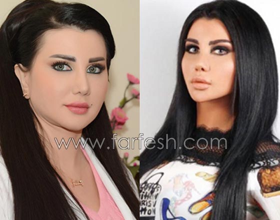 صور فنانات قمن بتكبير الشفاه. بينهن هيفاء واحلام وغادة. الفرق كبير قبل وبعد! صورة رقم 3