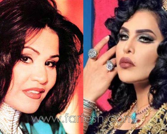 صور فنانات قمن بتكبير الشفاه. بينهن هيفاء واحلام وغادة. الفرق كبير قبل وبعد! صورة رقم 4