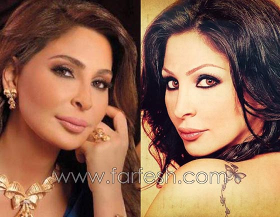 صور فنانات قمن بتكبير الشفاه. بينهن هيفاء واحلام وغادة. الفرق كبير قبل وبعد! صورة رقم 5