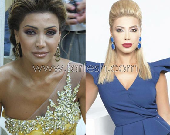 صور فنانات قمن بتكبير الشفاه. بينهن هيفاء واحلام وغادة. الفرق كبير قبل وبعد! صورة رقم 6