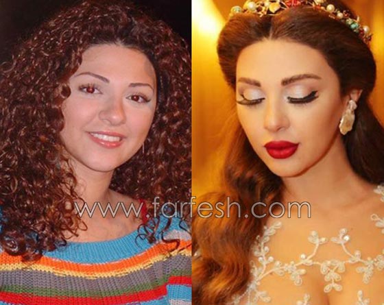 صور فنانات قمن بتكبير الشفاه. بينهن هيفاء واحلام وغادة. الفرق كبير قبل وبعد! صورة رقم 8
