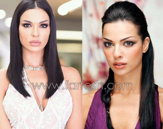 صور فنانات قمن بتكبير الشفاه. بينهن هيفاء واحلام وغادة. الفرق كبير قبل وبعد! صورة رقم 9