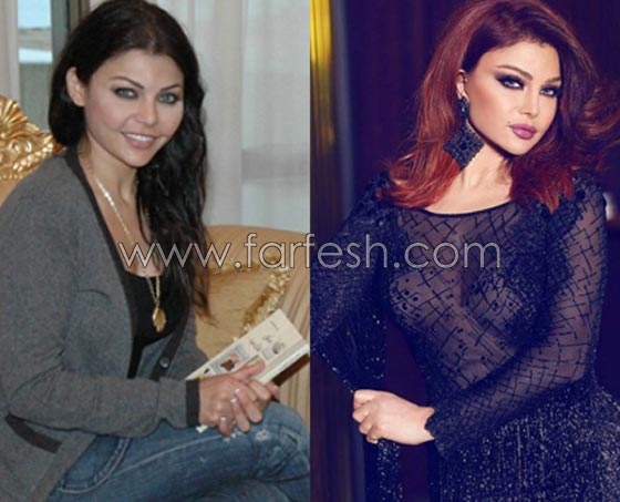 صور فنانات قمن بتكبير الشفاه. بينهن هيفاء واحلام وغادة. الفرق كبير قبل وبعد! صورة رقم 10