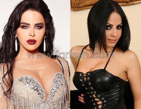 صور فنانات قمن بتكبير الشفاه. بينهن هيفاء واحلام وغادة. الفرق كبير قبل وبعد! صورة رقم 11